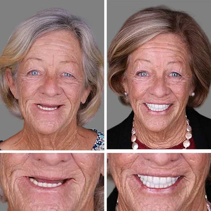 Ends Today: 49% OFF! ⏰ KLENIMORE™ Custom-Fit Smile Support Set — Strong Hold & Natural Look 🦷